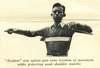 A boy stands with arms extended using splints.