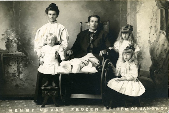 Man in wheelchair with lower legs bandaged.  Surrounded by woman and three young girls.
