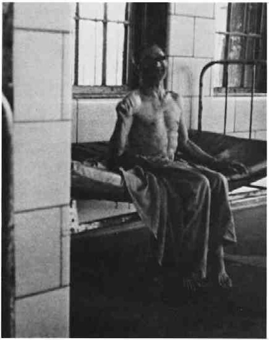 A partially clothed man sitting on a bed next to a barred window.